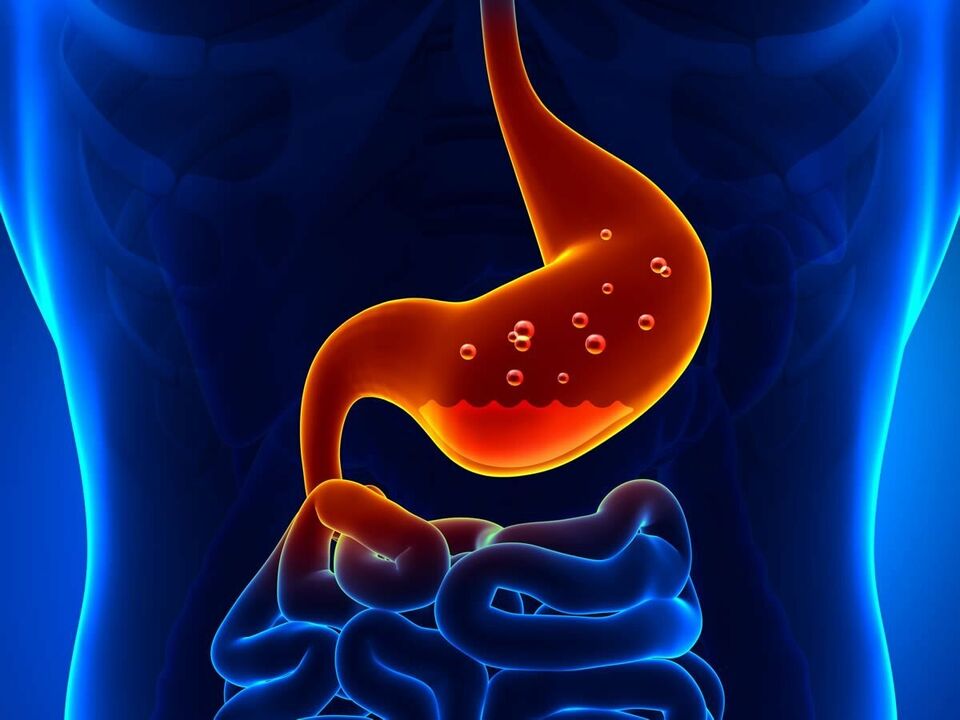 Zapalenie błony śluzowej żołądka to choroba zapalna żołądka wymagająca diety